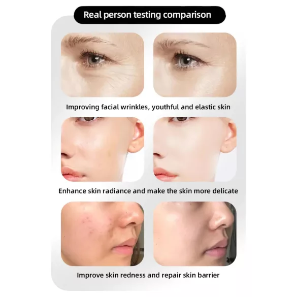 Photon Rejuvenation Veido Priežiūros LED Kaukė